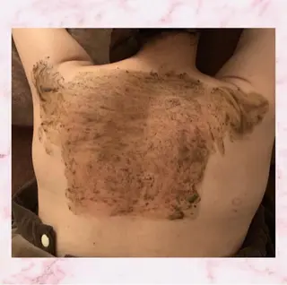 ハーブピーリング特選 認定rebirthのエステ・リラクイメージ