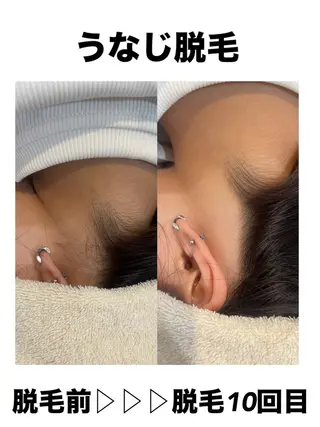 脱毛・眉毛・フェイス サロンN久留米店の眉毛・アイブロウイメージ