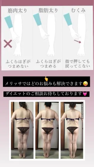 セミロング ヒーリングサロン メリッサ/tooSMILE所属・大屋 詩織のエステ・リラクイメージ