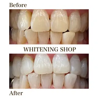 メンズ ホワイトニング ショップ川越店のエステ・リラクイメージ