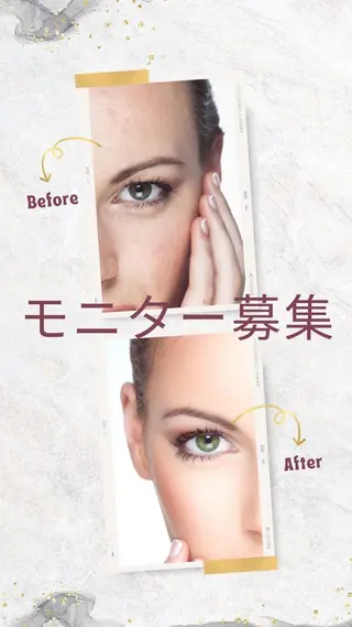 頭蓋骨小顔矯正 ハーブピーリングのエステ・リラクイメージ