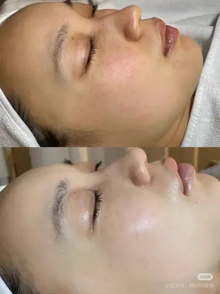 パーマ aliaハイフ&水光ジェットサロン所属・aliaハーブ水光店 エステティシャン募集のエステ・リラクイメージ