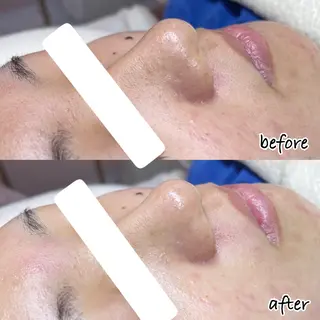 韓国肌管理専門店　White labo 新潟店所属・韓国肌管理専門店 Rihoのエステ・リラクイメージ