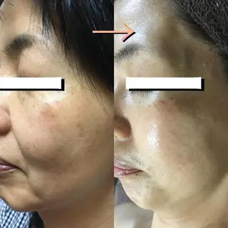 小顔筋膜矯正サロン桜Biscuit~サクラビスケット~所属・小顔/肩こり/脱毛 桜Bisucuitのエステ・リラクイメージ