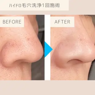 小顔&美肌品川店 Masqueradeのエステ・リラクイメージ