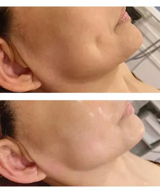 通うほど変わる本格 エステ心斎橋REVIのエステ・リラクイメージ