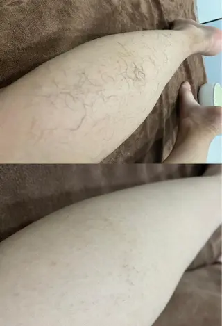 セルフエステエンリケ明石大久保店所属・夕希 毛穴と脱毛特化サロンのエステ・リラクイメージ