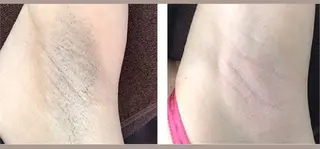 美肌脱毛サロン muroのエステ・リラクイメージ