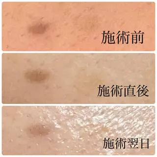 メンズ キッズ STELLAR. 谷岡恵里香のエステ・リラクイメージ