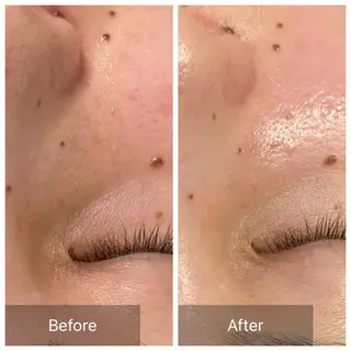 産毛専門店 Bittoのエステ・リラクイメージ