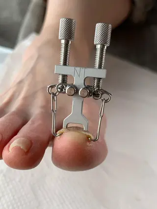 ネイル Takasaki Keikoのネイルデザイン