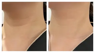 西区九条エステ MITUREIサロンのエステ・リラクイメージ