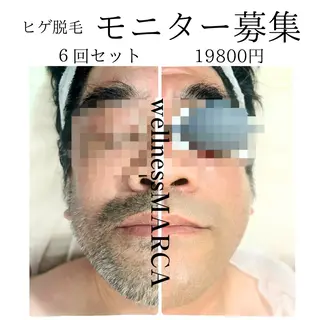 メンズ ネイル メンズトータルビューティーwellnessMARCA所属・【メンズ美容】 三浦かえでのエステ・リラクイメージ