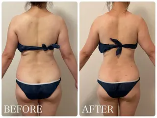 痩身小顔IRISER Akiのエステ・リラクイメージ