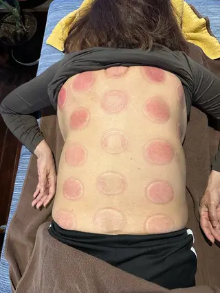 鍼灸院楽々館所属・宇田 碧のエステ・リラクイメージ