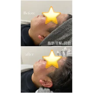 毛穴洗浄・痩身・脱毛 /アルカンジュのエステ・リラクイメージ