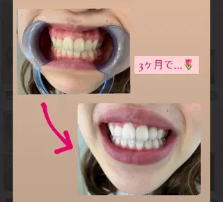 ecxia white 高田馬場所属・セルフホワイトニング エクシア 高田馬場のその他イメージ