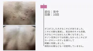 艶肌ワックス ALLY.のエステ・リラクイメージ