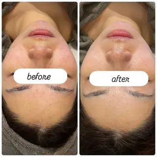 yellow.所属・yellow💛【 脱毛&フェイシャル】のエステ・リラクイメージ