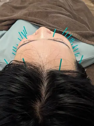 乃々鍼灸・整体院　表参道所属・乃々鍼灸整体院　植木 　【美容鍼/整体】のエステ・リラクイメージ