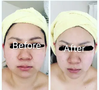 ヤマダ アキナのエステ・リラクイメージ