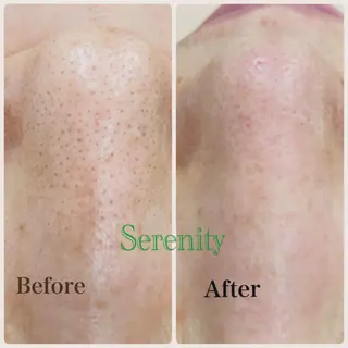 エステセレニティー 山本美樹のエステ・リラクイメージ