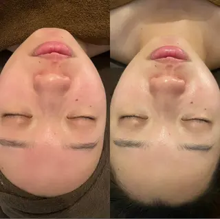 oyam オヤムのエステ・リラクイメージ