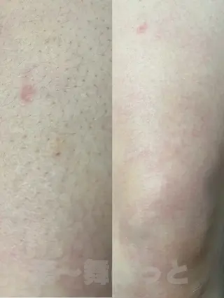 うえつま ふみえのエステ・リラクイメージ