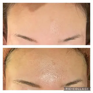 ミディアム カラー パーマ ヘアアレンジ メンズ キッズ ネイル マツエク・マツパ アイブロウ ニキビ特化型エステ 🍓最短で肌質改善のエステ・リラクイメージ