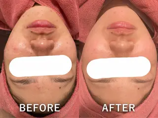 30minutes Rebeauty所属・Y 金子のエステ・リラクイメージ