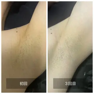 メンズ エマニエル USAのエステ・リラクイメージ