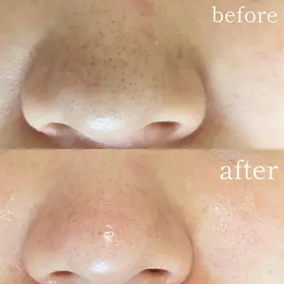 毛穴専門サロン　フルール所属・フルールFululu 自由が丘のエステ・リラクイメージ