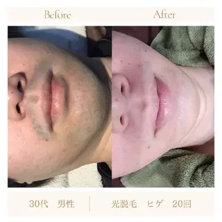 ラヴィエベル 中嶋のエステ・リラクイメージ