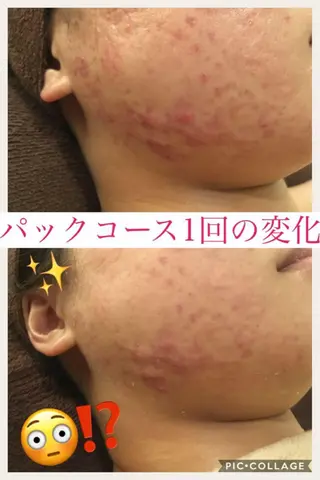 ショート カラー パーマ ヘアアレンジ メンズ キッズ ネイル マツエク・マツパ ニキビ・肌質改善専門 ♡人生が変わるサロンのエステ・リラクイメージ