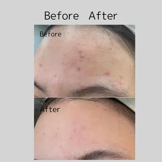 ナリスビューティサロンあべの所属・肌質改善/ツヤ肌作り /松本杏奈のエステ・リラクイメージ