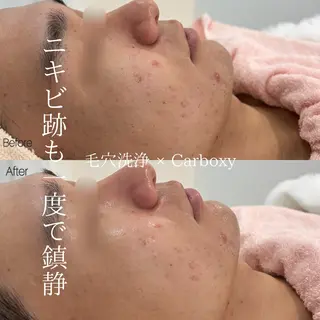 メンズ 〈etre〉トータルビューティーサロン所属・etre - 韓国肌管理 -のエステ・リラクイメージ