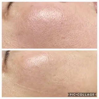 BeautySalonGemmy所属・Gemmy 愛美のエステ・リラクイメージ