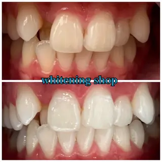 ホワイトニングショップ津店所属・ホワイトニング ショップ津店のその他イメージ