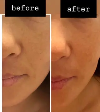 バリ式アロマ＆フェイ シャル_chiakiのエステ・リラクイメージ