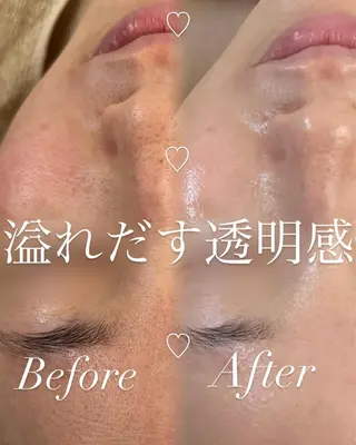 miki 東根の肌質改善サロンのエステ・リラクイメージ