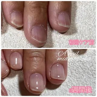 ネイル 大人可愛い高技術ネイ ル♡美爪A nailのネイルデザイン