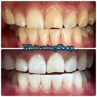 ホワイトニング ショップ吉祥寺店のエステ・リラクイメージ