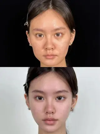 パーマ aliaハイフ&水光ジェットサロン所属・aliaハーブ水光店 エステティシャン募集のエステ・リラクイメージ