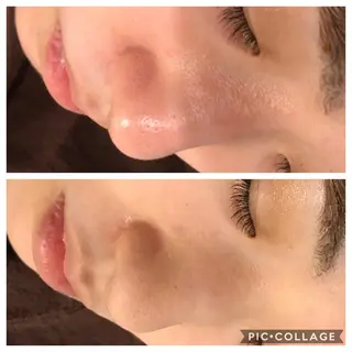 ショート カラー パーマ ヘアアレンジ メンズ キッズ ネイル マツエク・マツパ 四つ星サロン🎖 腸＆ニキビケアに特化のエステ・リラクイメージ