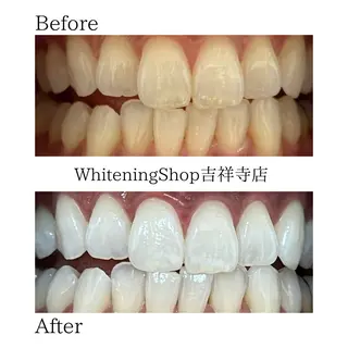 ホワイトニング ショップ吉祥寺店のエステ・リラクイメージ