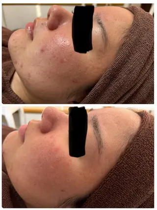 【Resetlab】 Chihiroのエステ・リラクイメージ