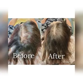 歯科提携セルフダック 宇都宮駒生店のエステ・リラクイメージ