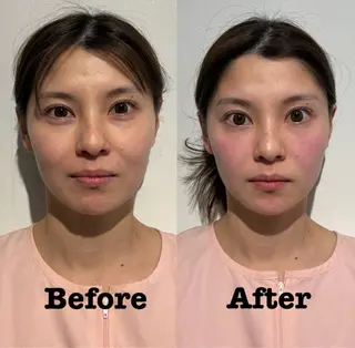 鍼灸サロン mahorobaトモのエステ・リラクイメージ