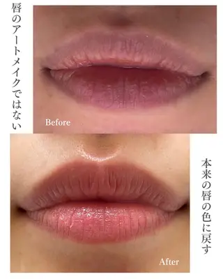 小顔/たるみ/黒ずみ除去専門サロン/SONA 大和西大寺店所属・【小顔専門看護師 サロンSONA】のエステ・リラクイメージ