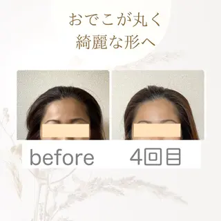 小顔矯正サロン　クレール所属・小顔矯正専門サロン クレールのエステ・リラクイメージ